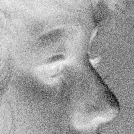 High grain image